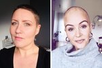 Dýrt að veikjast á Íslandi