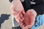 Dóttirin þorir varla út eftir að hundur beit hana til blóðs