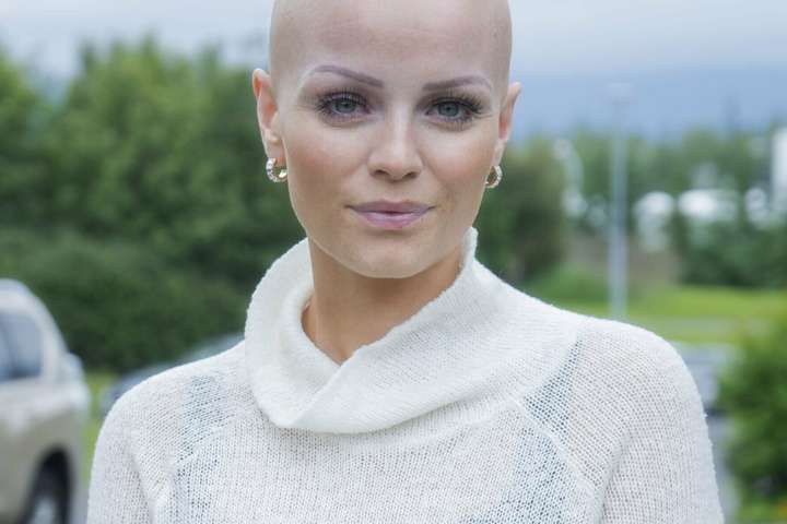 Glæsileg og nauðasköllótt Ragna: „Þetta er mjög sárt og oft saknar maður þess að vera með hár“
