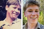 Sonur Steve Irwin bitinn í andlitið af sömu snákategund og pabbinn: „Ég fór aðeins of nálægt honum“