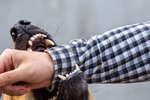 Heimilishundur beit ættingja eiganda í handleggi í hverfi 113
