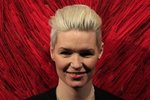 Brynjar skýtur fast á Hildi Lilliendahl: „Hvers á þetta yndislega fólk að gjalda?“