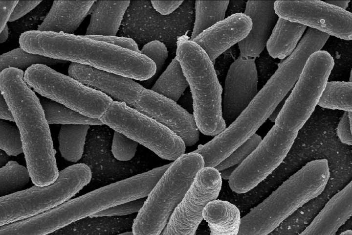 Heilbrigðiseftirlit Reykjavíkur innkallar ost vegna E. coli