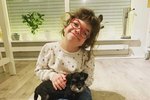 Anna Lilja glímir við mjög sjaldgæfan sjúkdóm: „Hún er lífsglöð og hugrökk og rosalegur karakter“